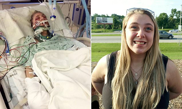 Gifted student's life takes another shock turn years after clawing out her eyeballs and